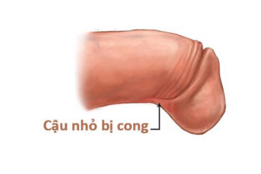 Cắt bao quy đầu có làm tăng kích thước cậu nhỏ không? Sự thật là gì?